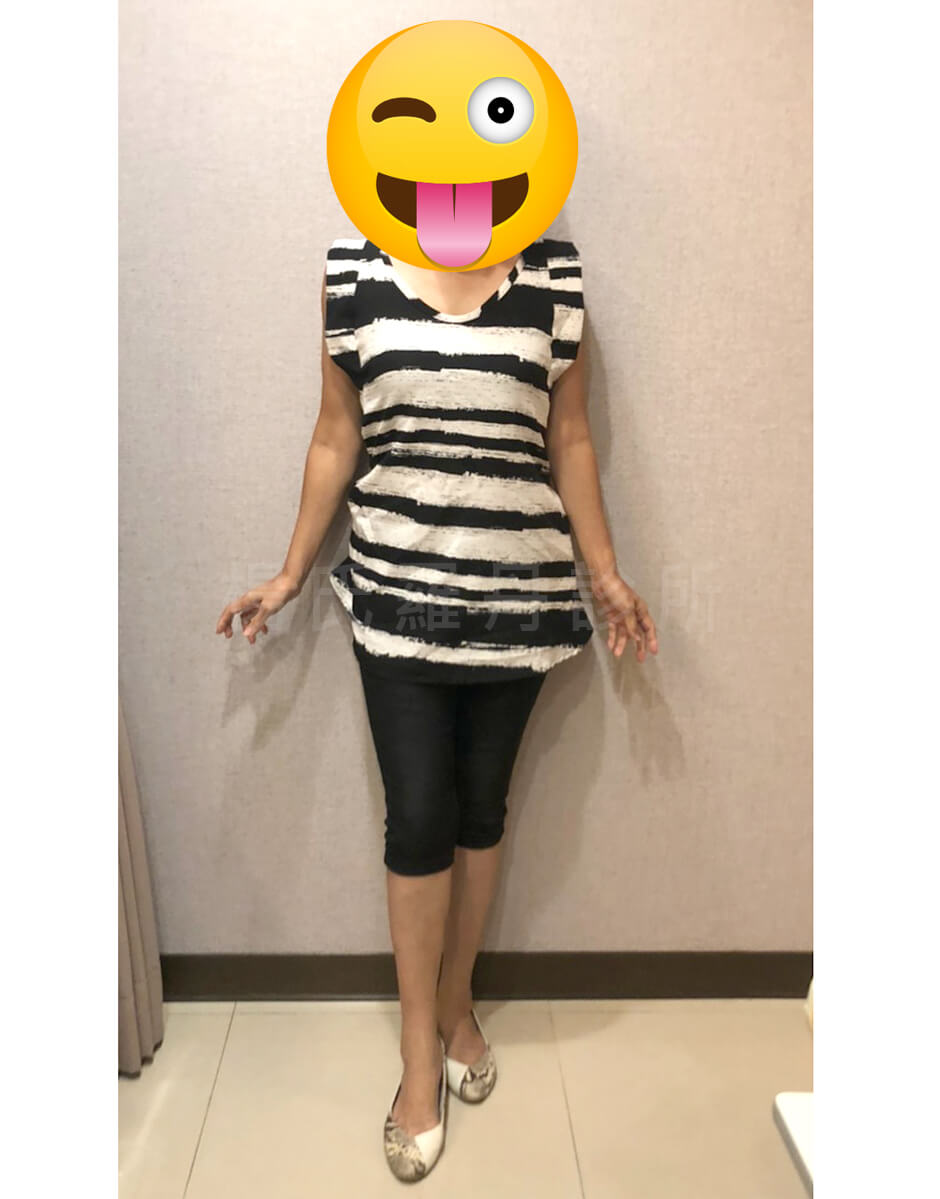 減肥 瘦身 肥胖